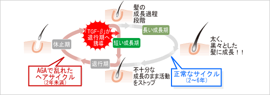髪の成長過程段階で、AGAで乱れたヘアサイクルは成長期が短く不十分な成長のまま活動をストップさせ、２年未満のサイクルとなります。正常なサイクルは成長期が長く、太く黒々とした髪に成長し2～6年のサイクルです。