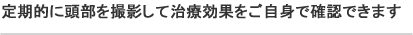 定期的に頭部を撮影して治療効果をご自身で確認できます